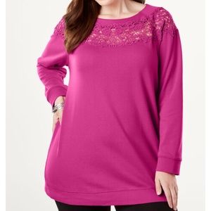Roaman’s Lace Tunic